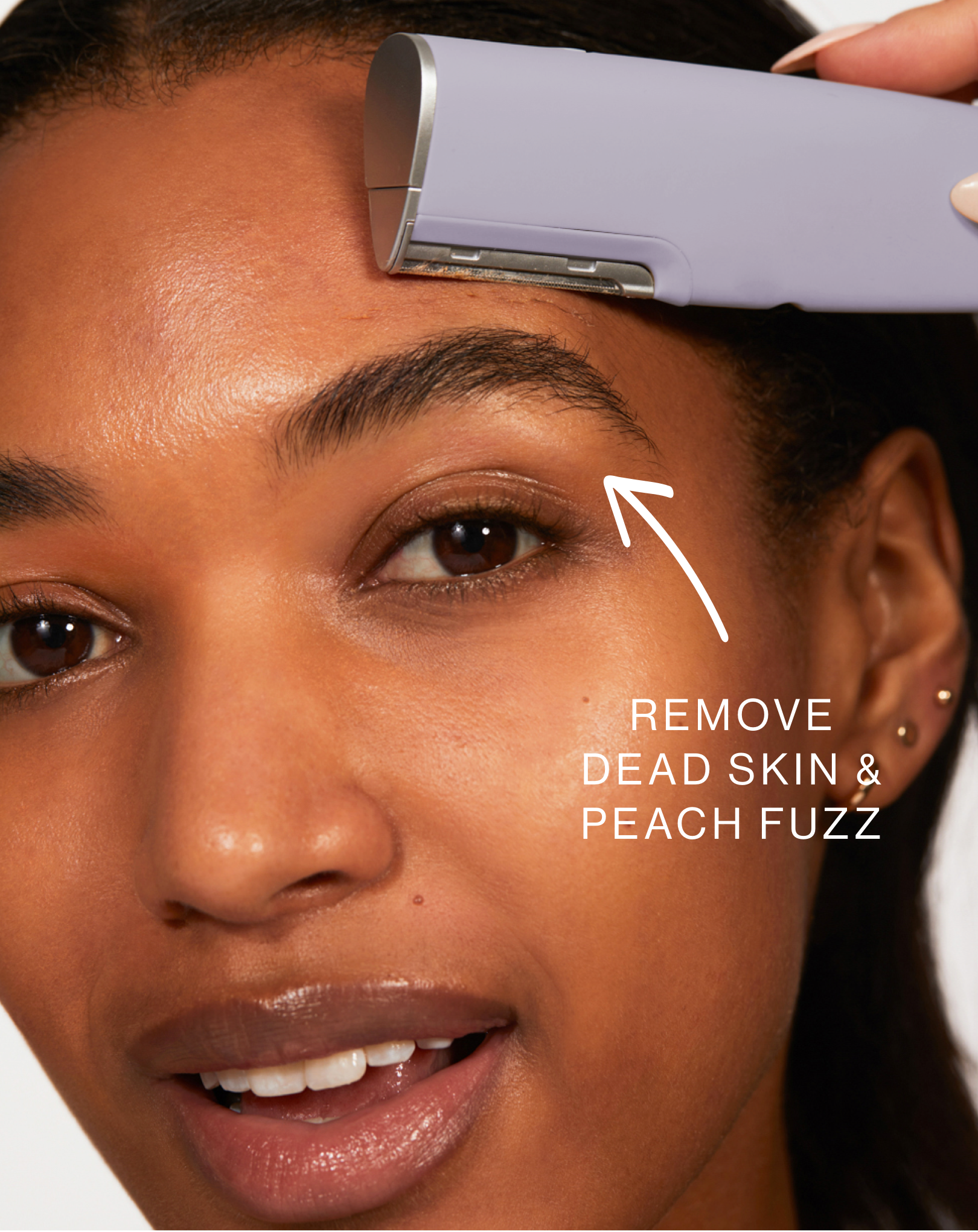 DERMAFLASH LUXE+