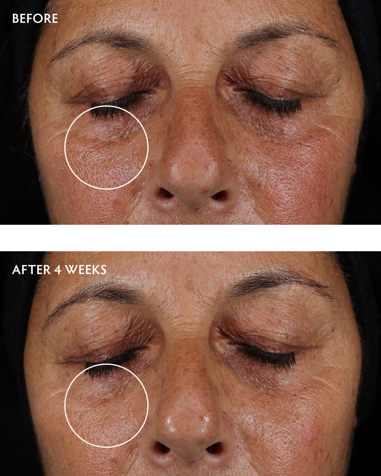 Caffeine + Peptide Smoothing Eye Serum